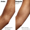 Before and after comparison of a person's leg with hyperpigmentation on the left and uniform skin tone on the right.