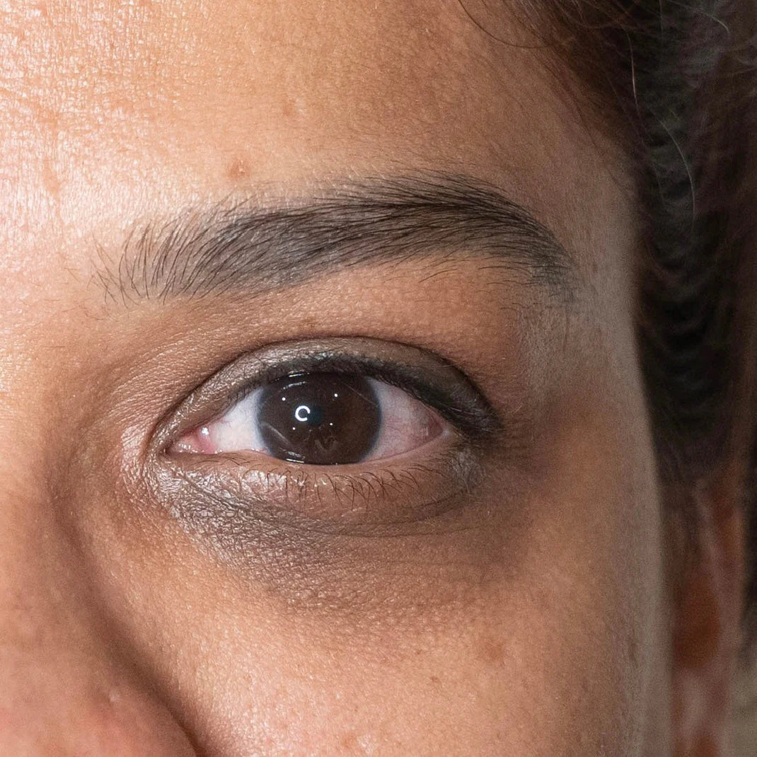Zona de los Ojos y Cejas