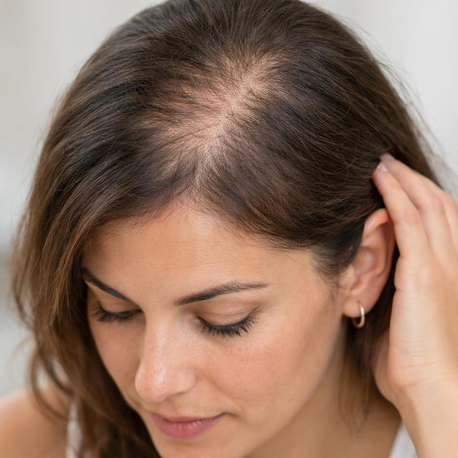 Caída del Cabello