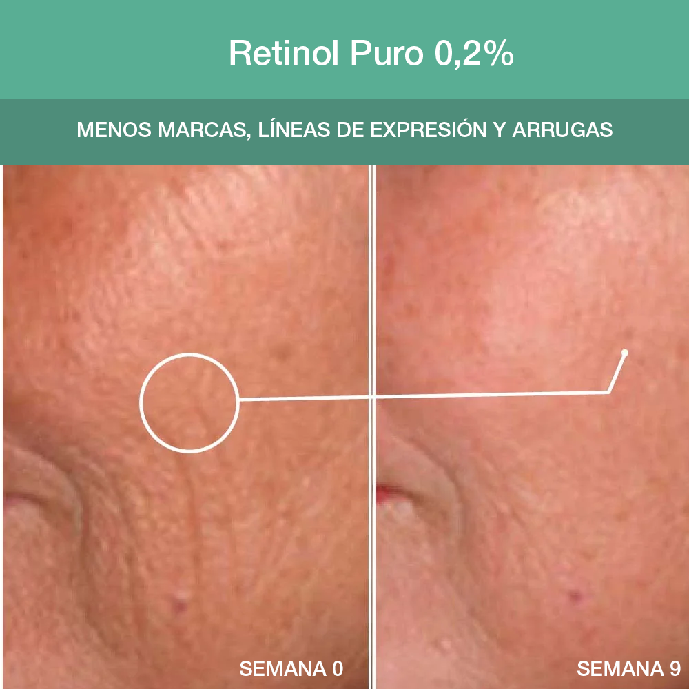 Retinol Advance Cápsulas: Serum de Retinol y Aceite de Macadamia